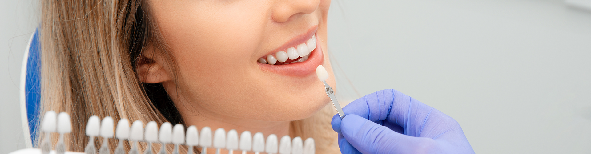 gloved hands-holding tooth shade-matching tool against woman's smile.